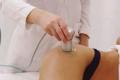 Cellulite treatment with ultrasound