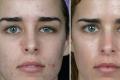 Cura del viso dopo la pulizia del viso Pulizia meccanica del viso prima e dopo