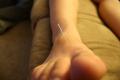 Ancient-Chinese Acupuncture Points - Basic Points on the Body