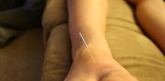 Ancient Chinese acupuncture points - the main points on the body